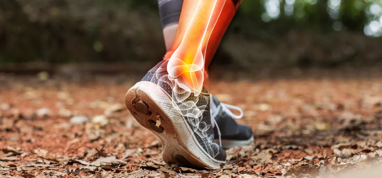 Una mujer está haciendo senderismo por la montaña y se muestra su pie con una radiografía superpuesta 