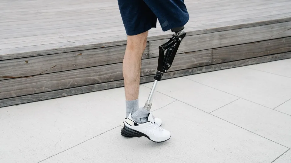 Se muestran las piernas de un hombre caminando con una pierna biónica